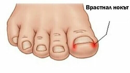 Vesimed - Medical Pedicure Podolog София - снимка 1