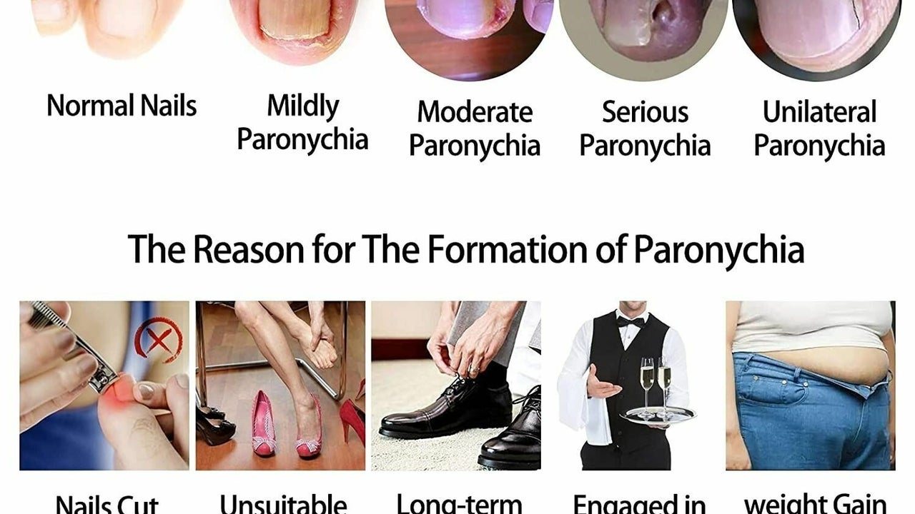 Vesimed - Medical Pedicure Podolog София - снимка 2